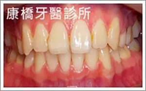 case006_S_DSCN2058