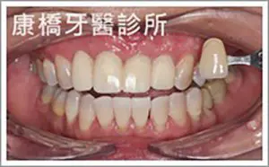 case008_S_IMG_1230