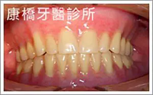 case009_S_DSCN0006