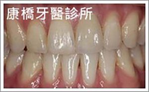 case014_S_case1403