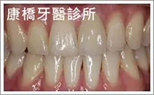 case014_S_case1403