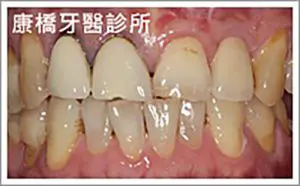 case015_S_IMG_2587
