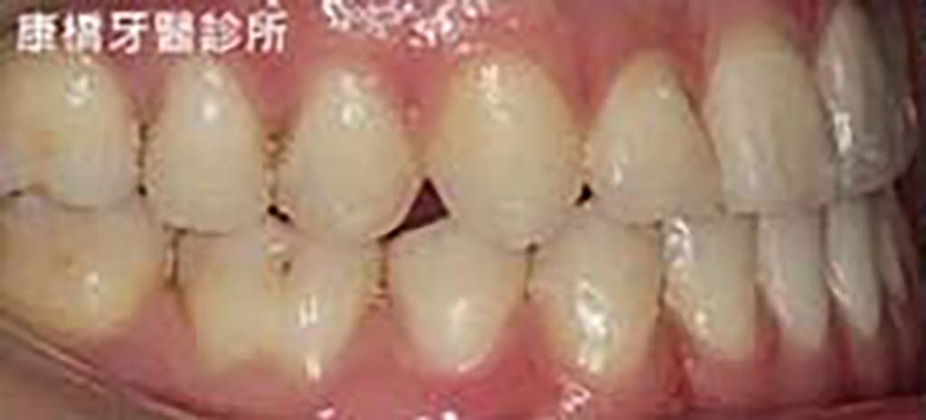 case1402