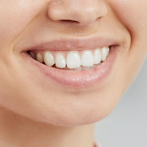 缺門牙容易發生嗎？門牙缺牙怎麼辦康橋牙醫告訴你