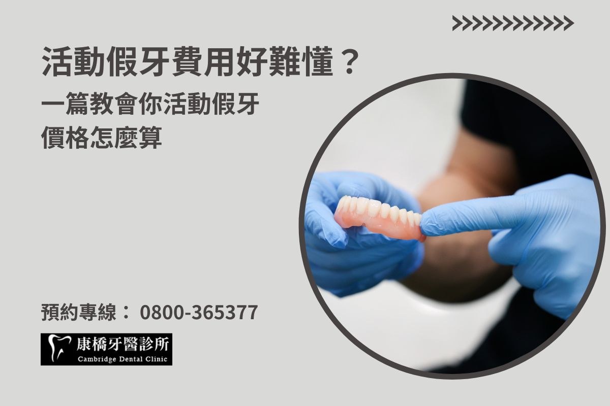 最新消息 1 活動假牙費用好難懂?一篇教會你活動假牙價格怎麼算