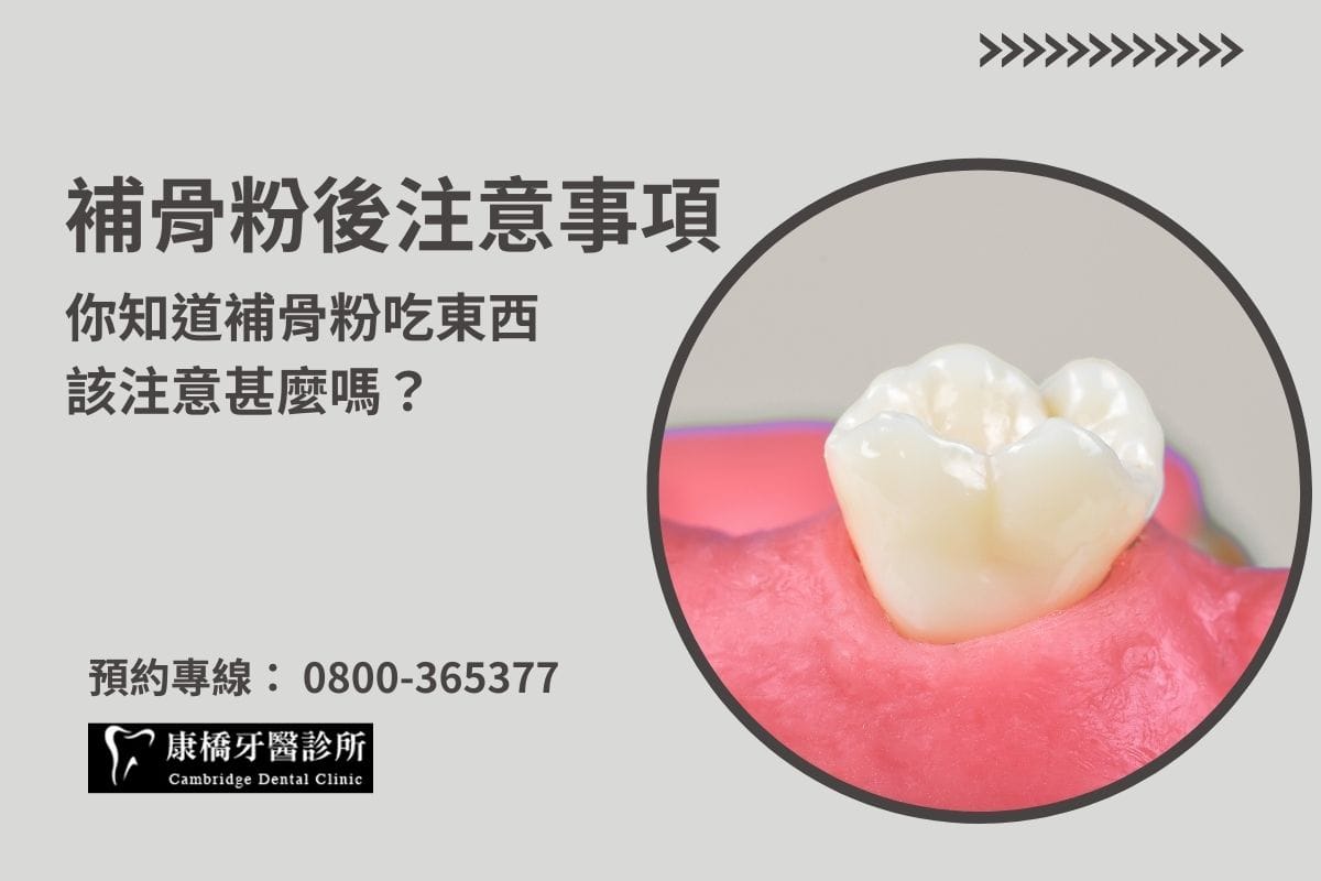 補骨粉後注意事項，你知道補骨粉吃東西該注意甚麼嗎？