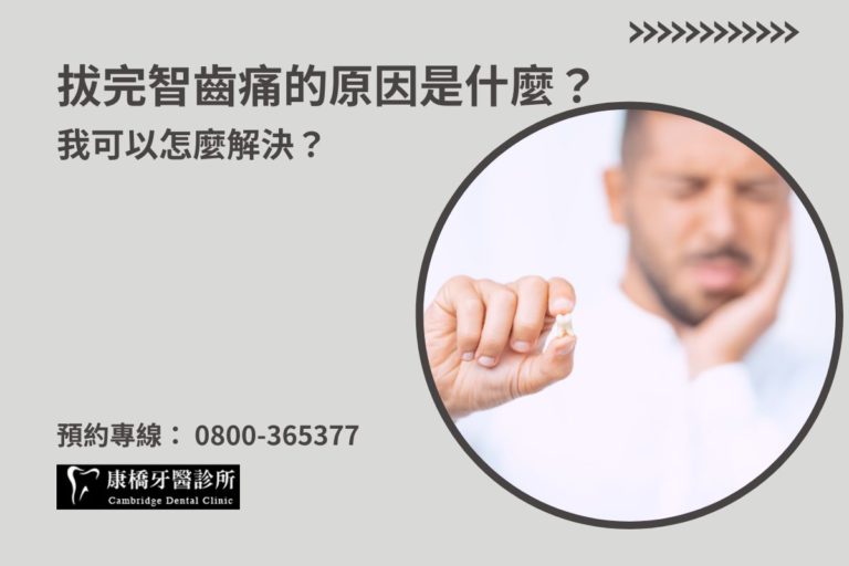 Read more about the article 拔完智齒痛的原因是什麼？我可以怎麼解決？