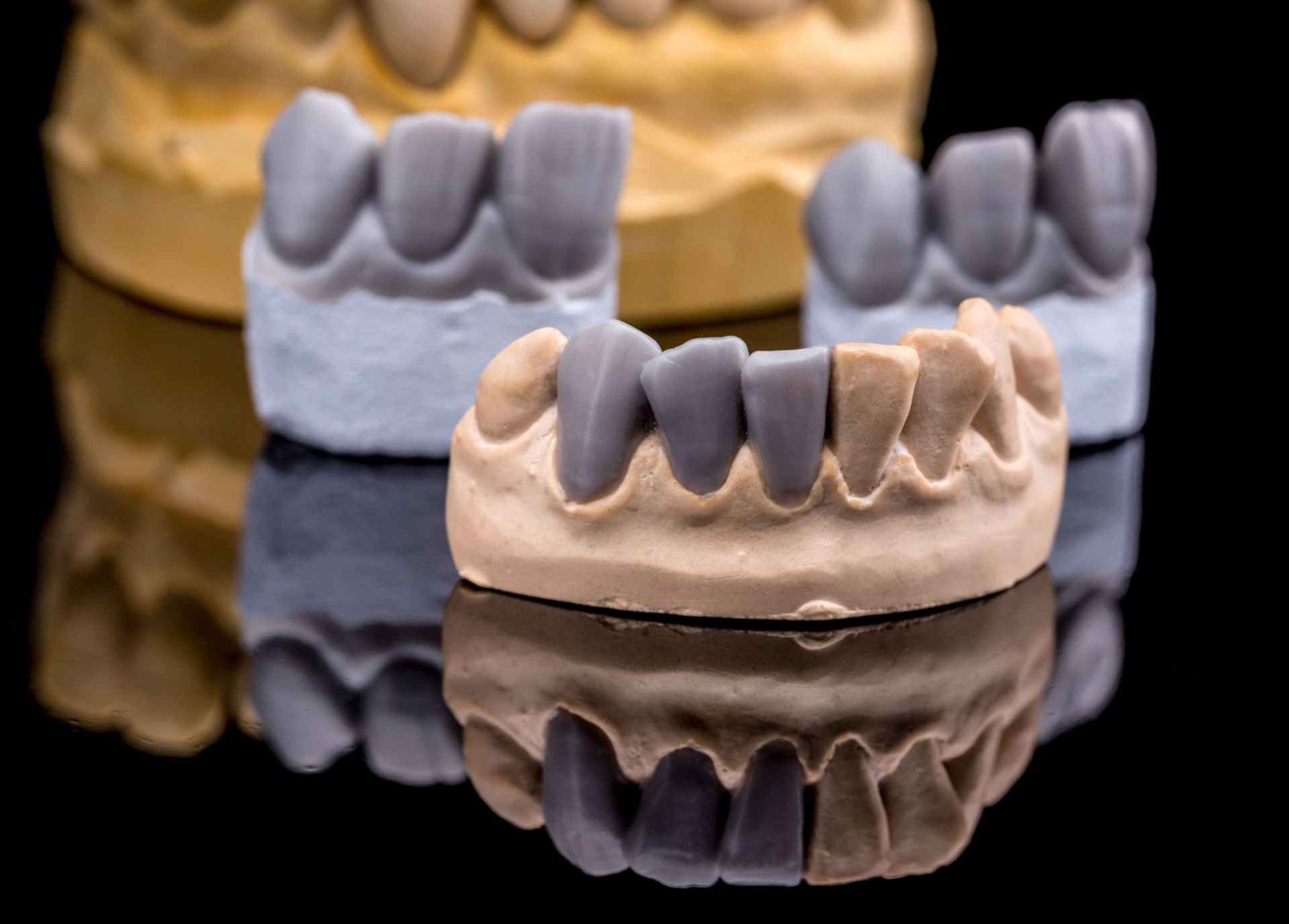 artificial tooth 2021 08 26 17 52 13 utc 1 scaled