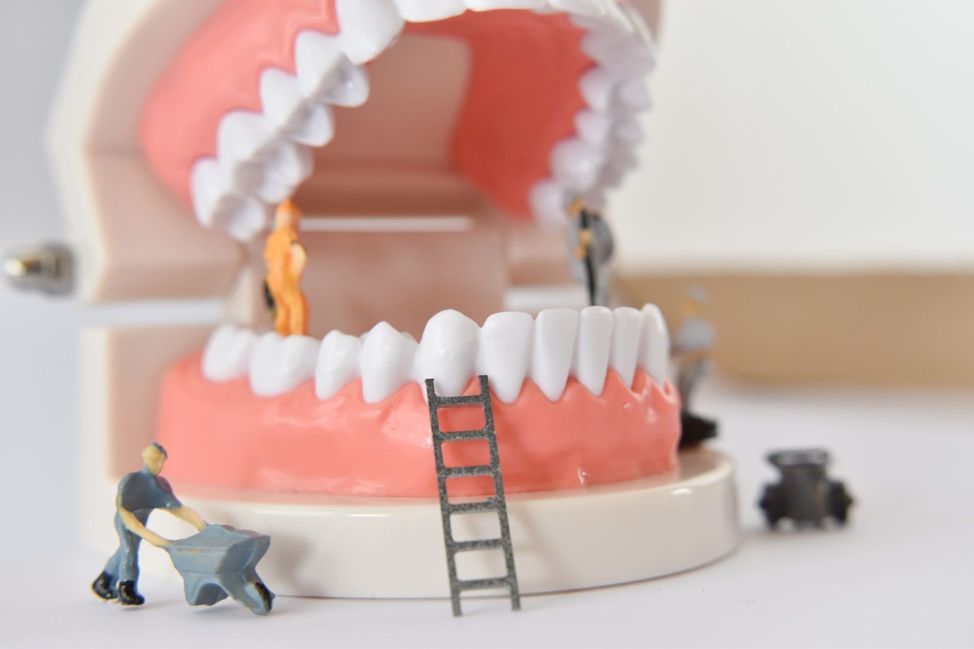 Read more about the article 臨時假牙負責的任務有哪些？伴您渡過缺牙後的陣痛期
