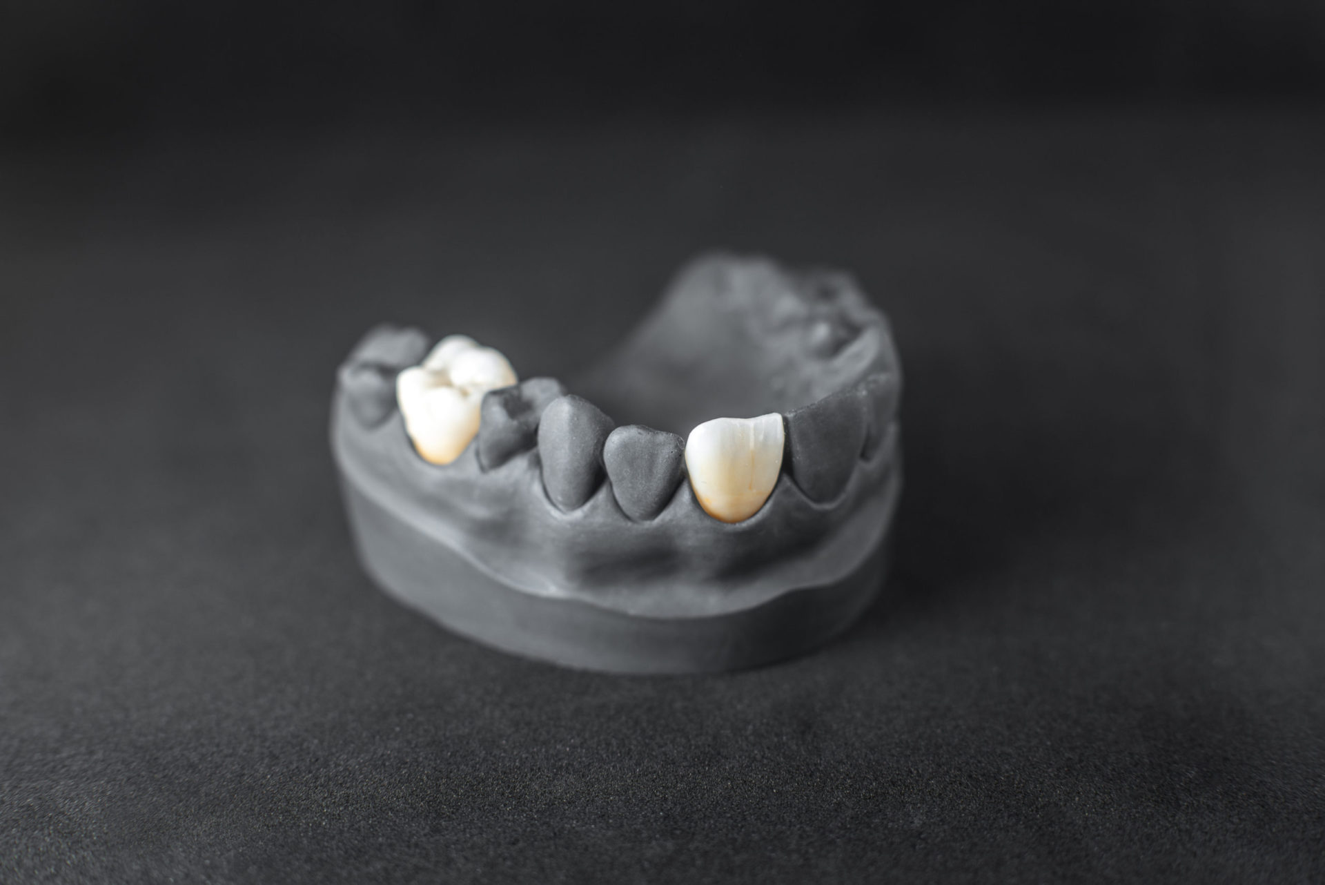 model of artificial jaw with dental implant 2021 09 01 14 47 40 utc scaled