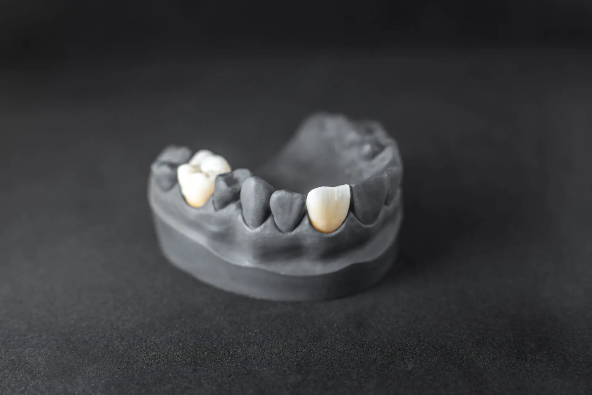 model of artificial jaw with dental implant 2021 09 01 14 47 40 utc scaled