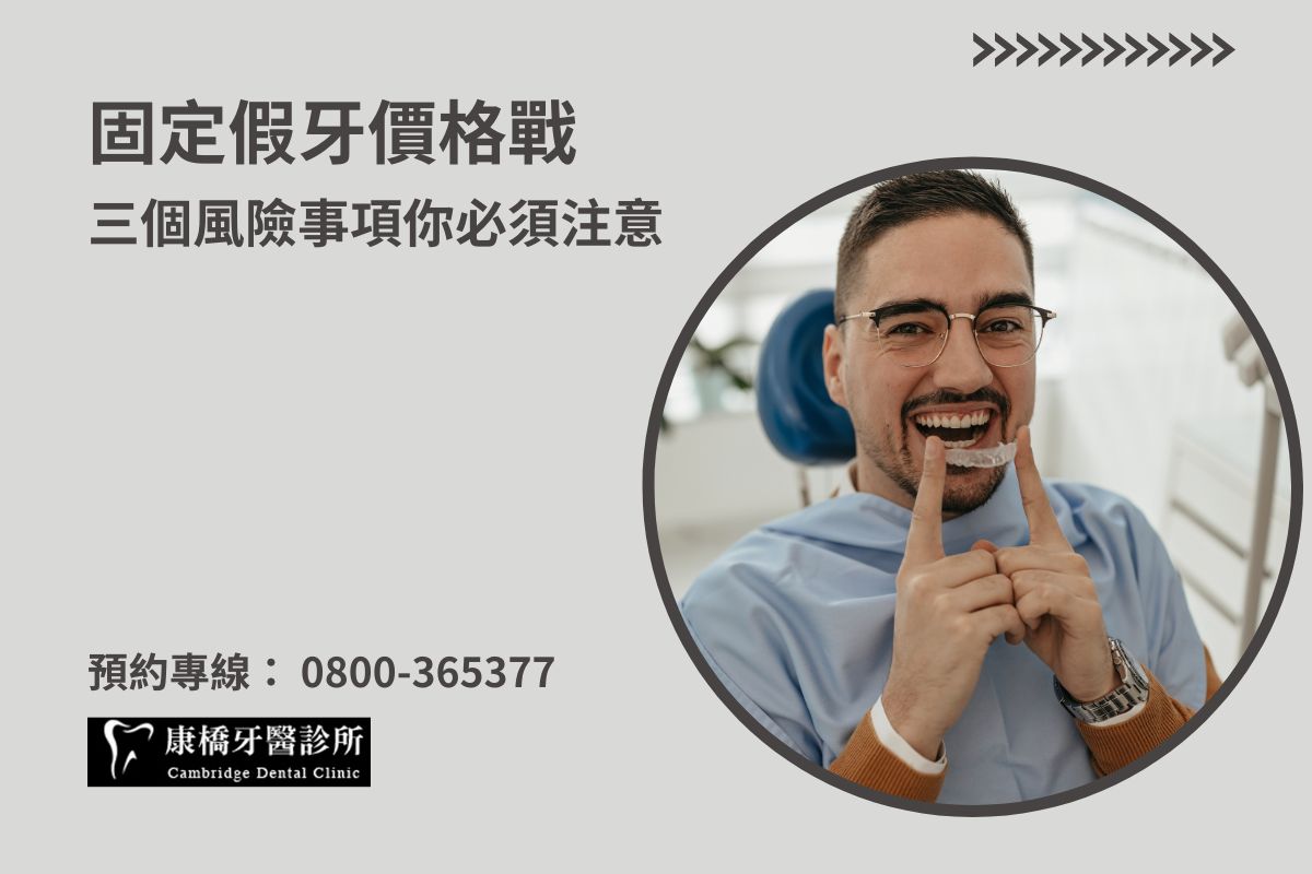 固定假牙價格戰：三個風險事項你必須注意