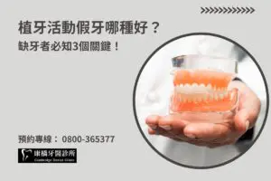 植牙活動假牙哪種好？缺牙者必知3個關鍵！